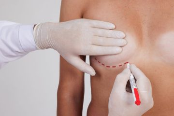 Reafirmación de senos tras el embarazo: alternativas sin marcas